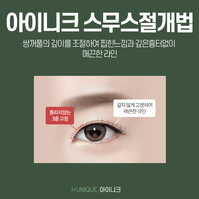 쌍수성형외과 찾다가 지쳤다면 아이니크에서 결정하자 관련 이미지 4