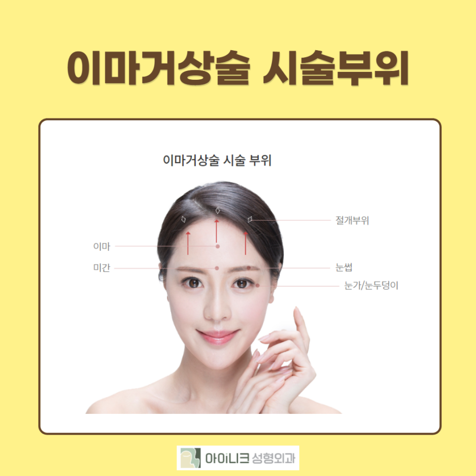 눈썹거상술로 티나지 않고 또렷한 인상으로! 관련 이미지 4