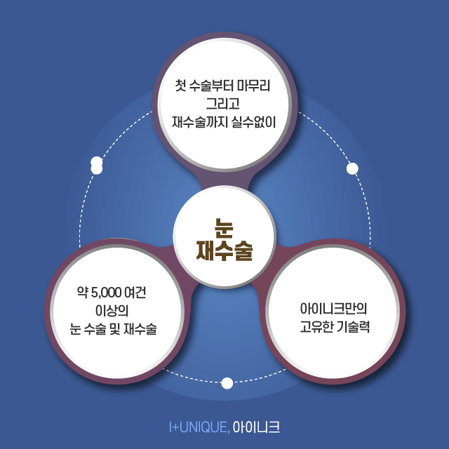 눈재수술성형외과 고를 때 이것만 알아주세요! 관련 이미지 7
