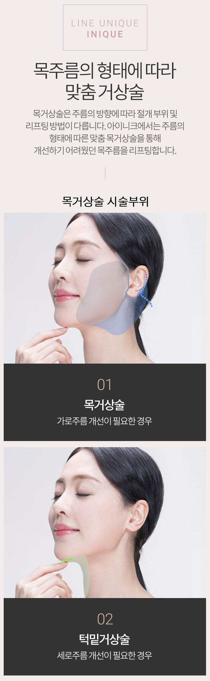 목주름수술비용이 궁금하다면? 관련 이미지 2