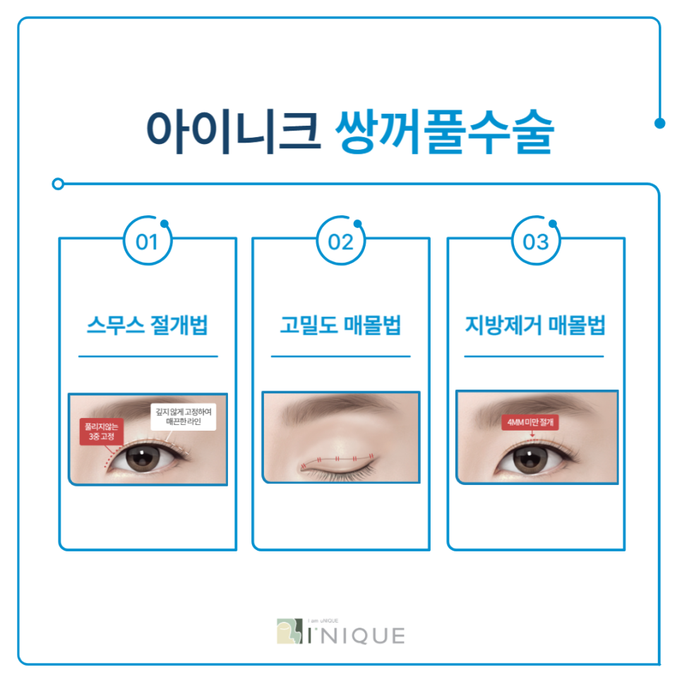 눈크게하는수술 절개법이란? 관련 이미지 2