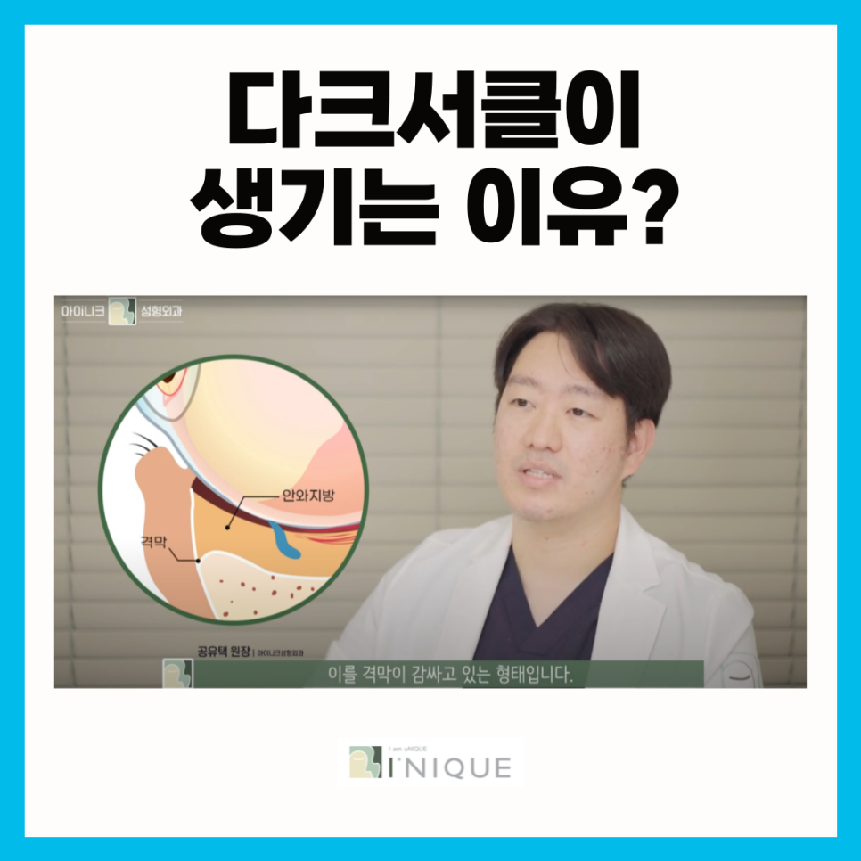 눈밑주름리프팅으로 환하고 맑은 인상 관련 이미지 3