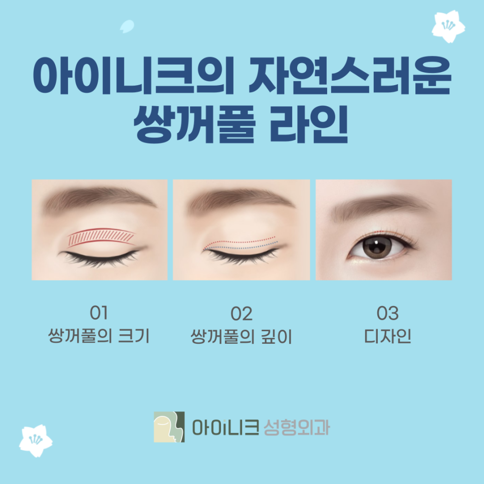 쌍수잘하는병원 잘 선택하는 기준은? 관련 이미지 6