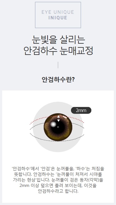 비절개눈매교정술 간단하지만 확실한 관련 이미지 2
