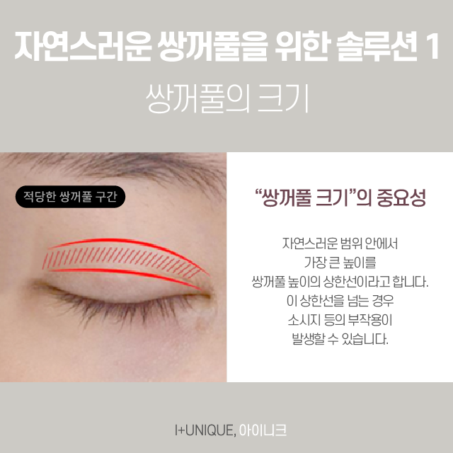 자연스러운쌍꺼풀을 원한다면 지금 바로 클릭! 관련 이미지 3