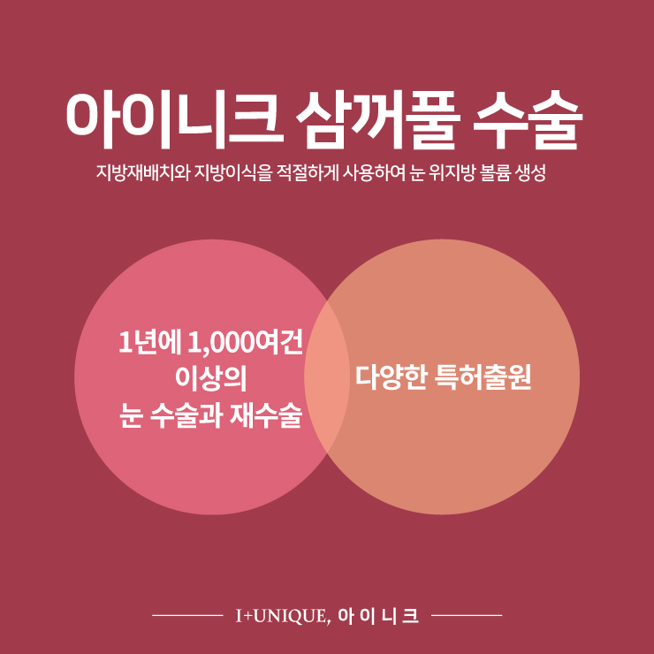 쌍꺼풀이 여러겹? 삼꺼풀 탈출하기 #2 관련 이미지 5