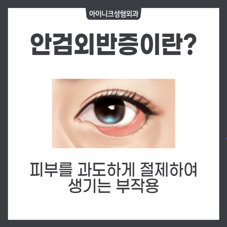 중년성형, 다시 20대의 눈매로 관련 이미지 5