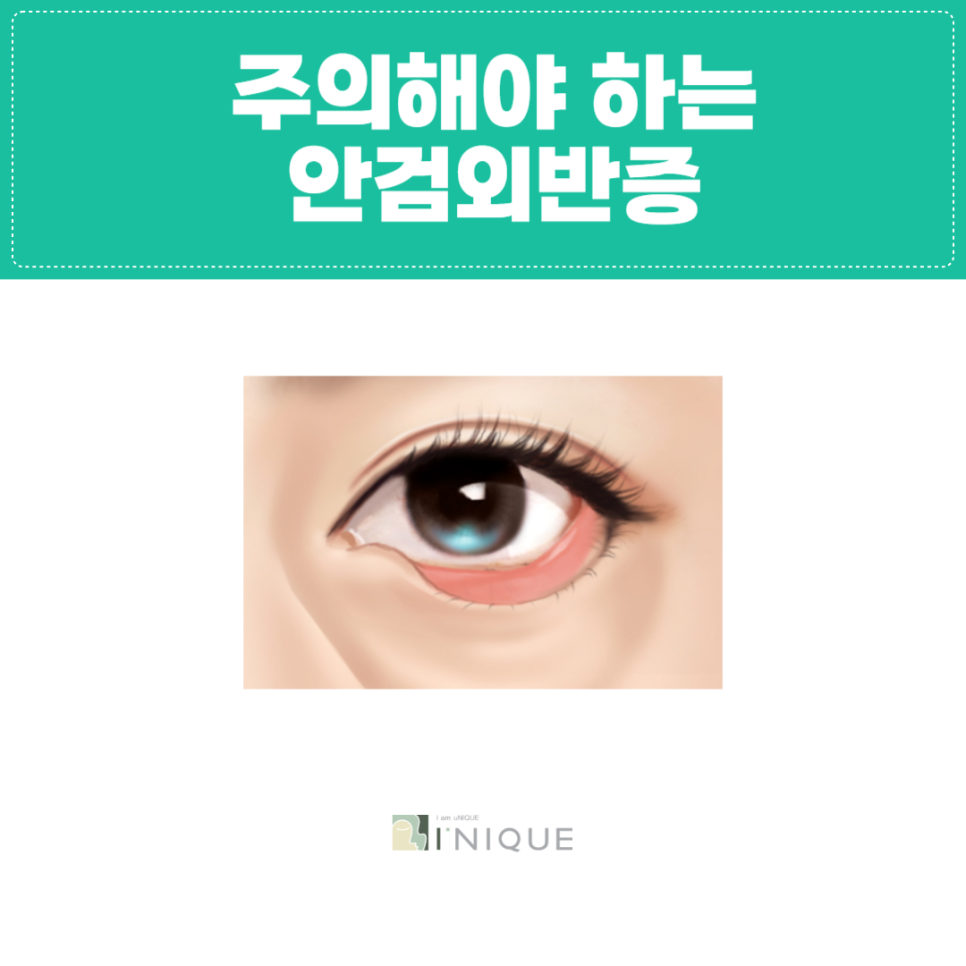 Is Double Eyelid Surgery in Your 50s the Right Choice? image 4