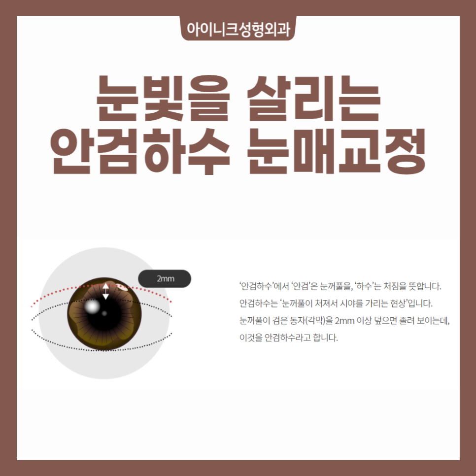 When Ptosis Correction Is Needed image 2