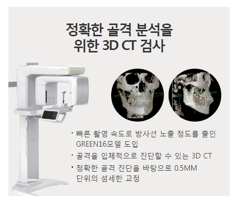 긴얼굴양악 최소 선교정으로 안전하고 확실하게! 관련 이미지 4