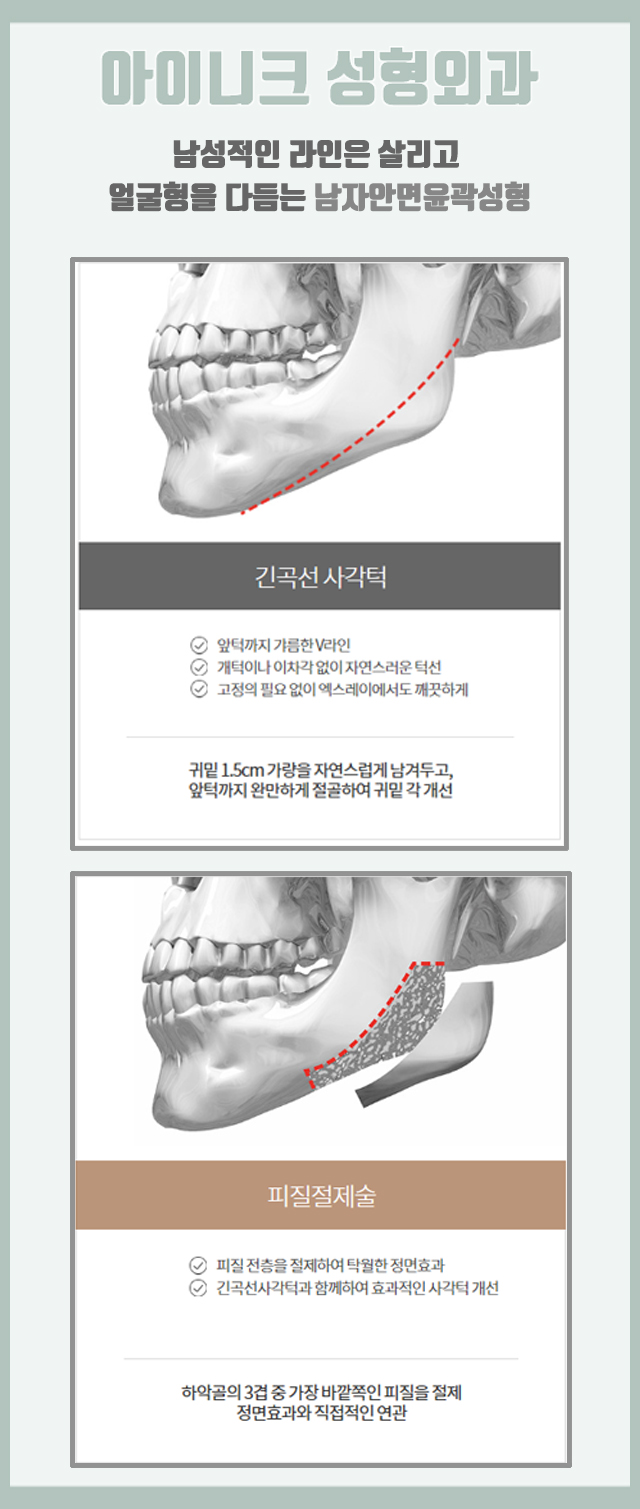 남자무턱수술 정확한 검사를 통한 맞춤 디자인! 관련 이미지 4