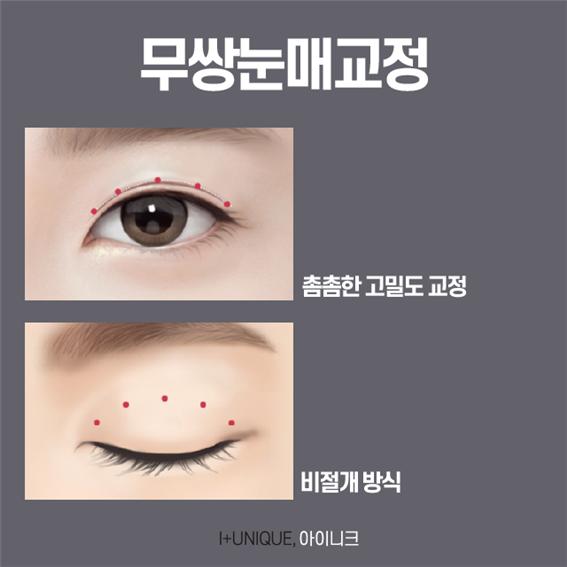 남자눈재수술 잘하는 곳 궁금하다면 관련 이미지 4