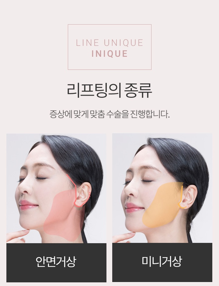 안면거상술재수술 고민 중이라면? 관련 이미지 2