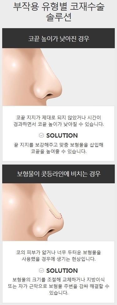 늑연골코성형 코재수술 잘하는 곳 관련 이미지 4