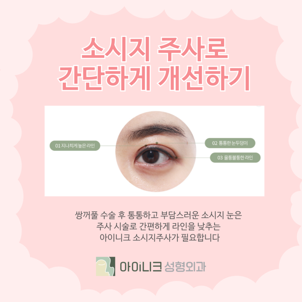 How to Reduce Double Eyelid Surgery Swelling and the Sausage Injection image 5