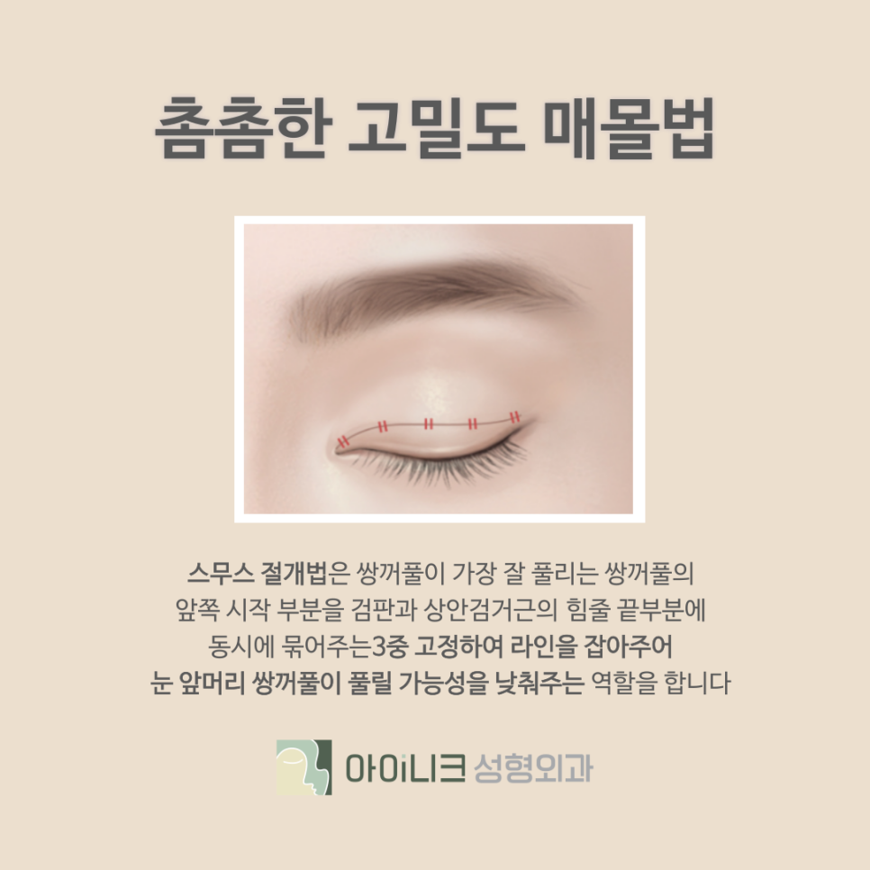 Why You Should Choose Aineek, a Plastic Surgery Clinic Near Apgujeong Station image 5