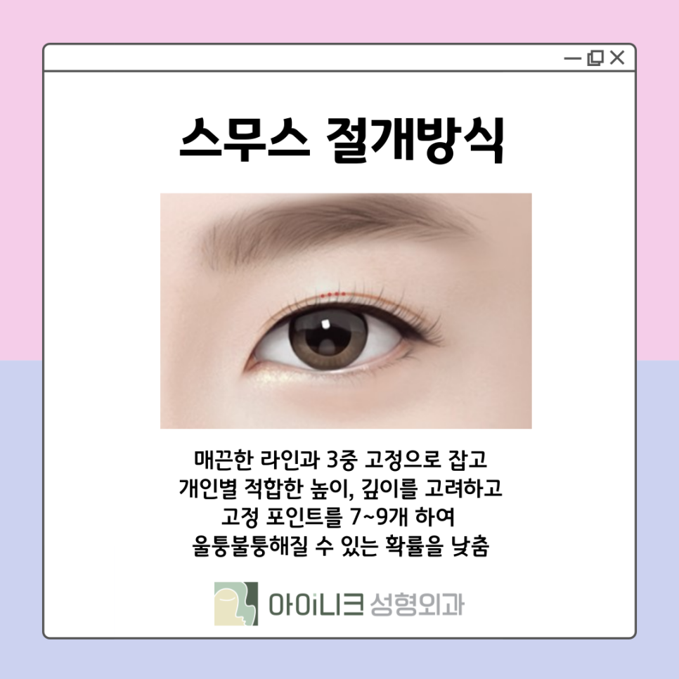 쌍꺼풀재수술잘하는병원 눈꺼풀이 울퉁불퉁하다면? 관련 이미지 11