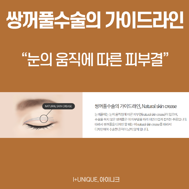 20대눈성형 자연스러움이 최고 관련 이미지 5