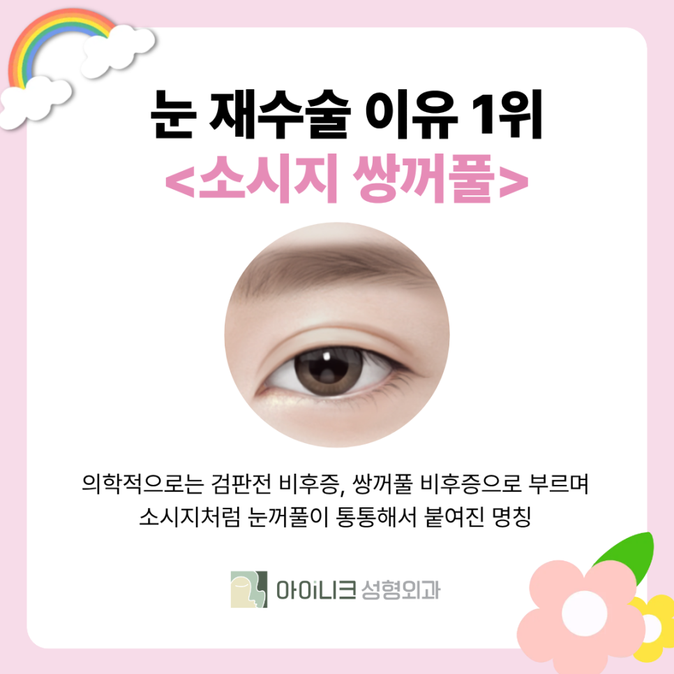 Revision Surgery for “Sausage Eyes”: How Should Thick Double-Eyelid Folds Be Corrected? image 2