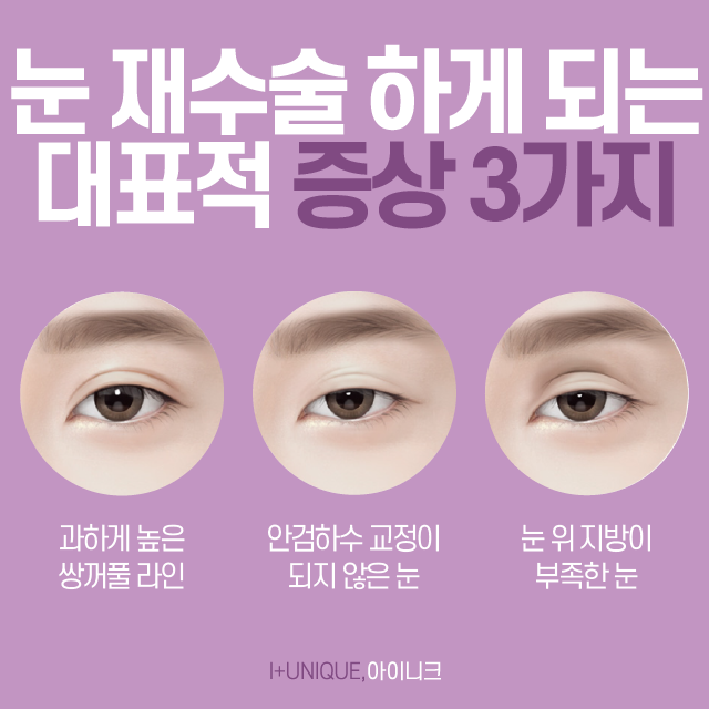 Want to Lower Your Double Eyelid Line? For Revision Surgery, Choose a Place You Can Trust! image 2