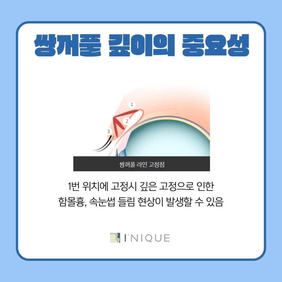 쌍꺼풀수술 후 흉터가 고민이라면 관련 이미지 6
