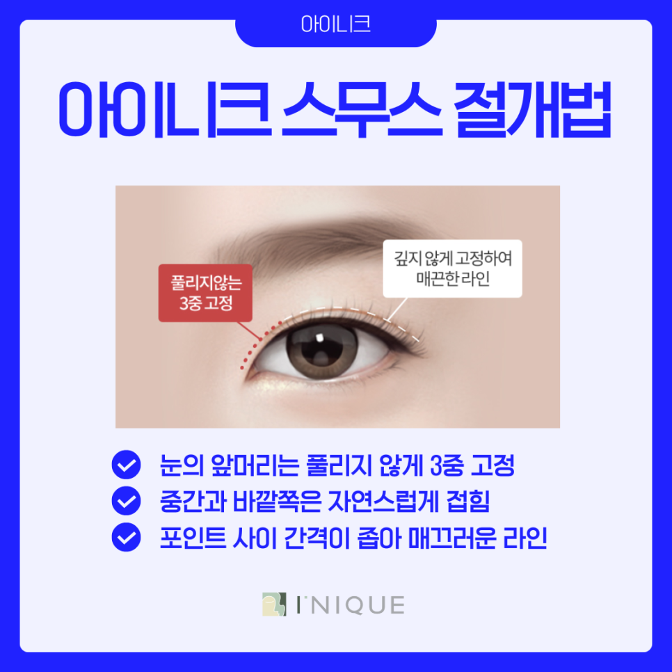 압구정 쌍수 라인 추천 어떻게? 관련 이미지 6