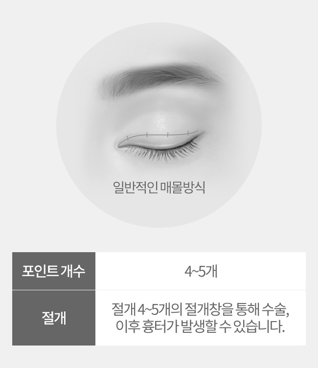 티안나는쌍수 아이니크의 노하우로! 관련 이미지 4