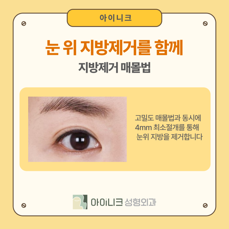 첫인상 바꾸고 싶다면? 압구정성형외과에서 시작하는 변화 관련 이미지 9