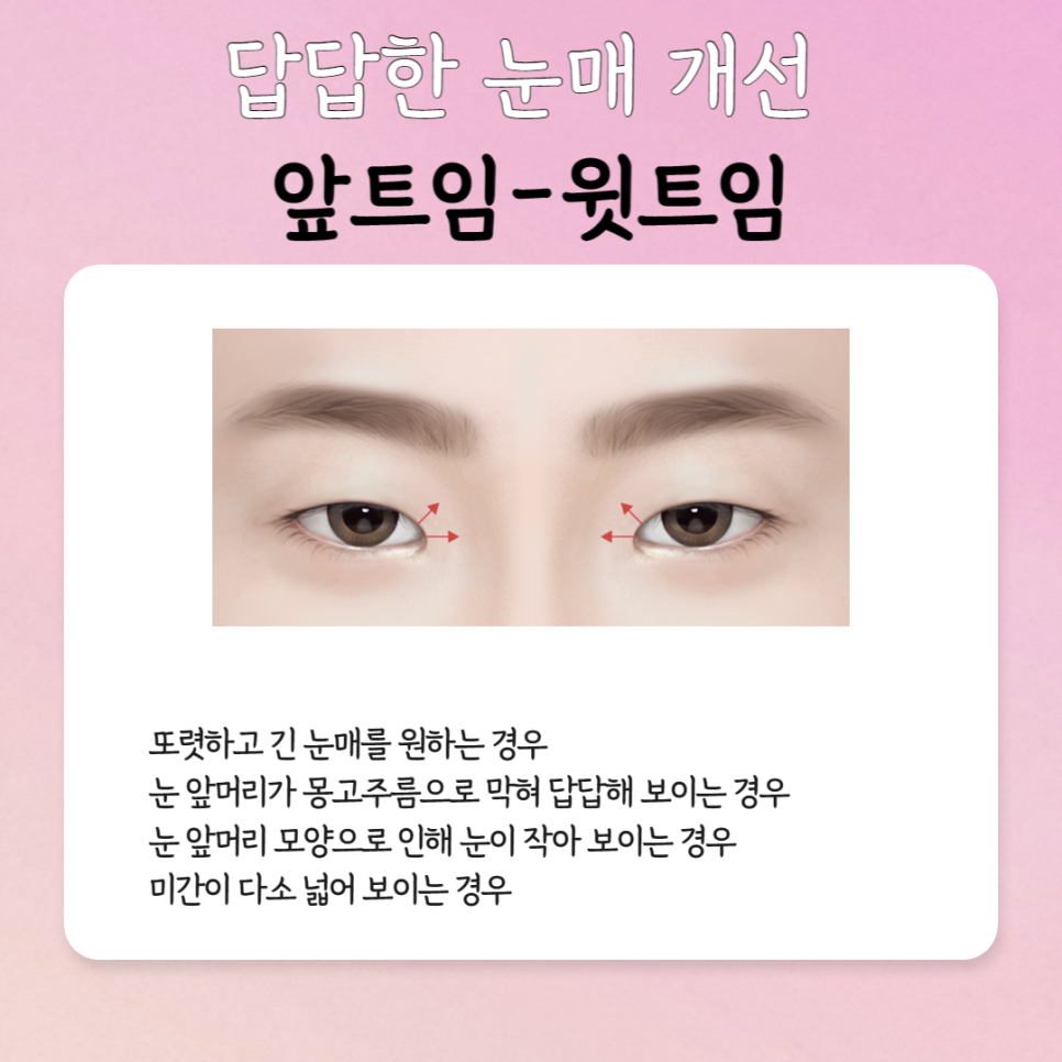 The Best Place for First-Eye Surgery Is Right Here image 4