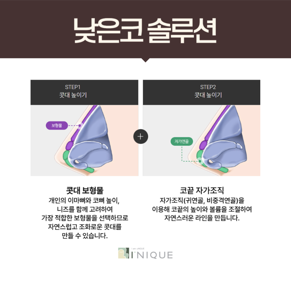 복코성형외과 여기서 성공 관련 이미지 4