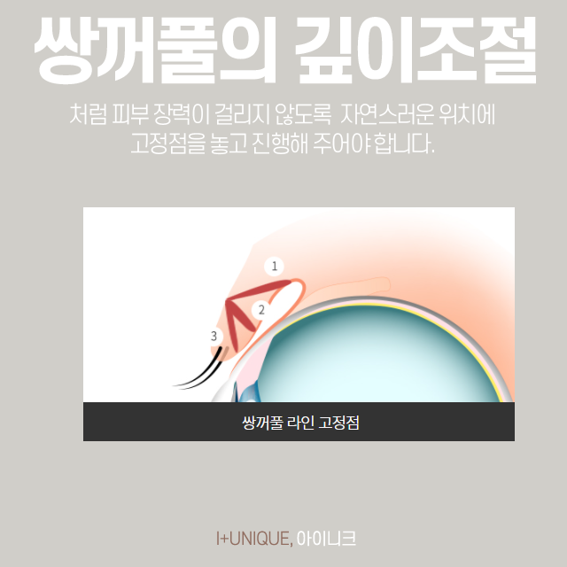 속눈썹들림으로 속상한 내 눈, 어떻게 되돌릴 수 있을까? 관련 이미지 4