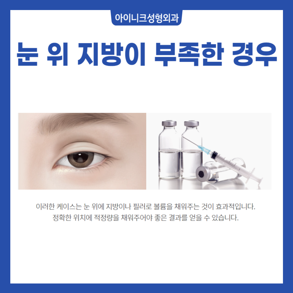 소시지눈재수술 원인부터 파악해야 실패 없어요 관련 이미지 5