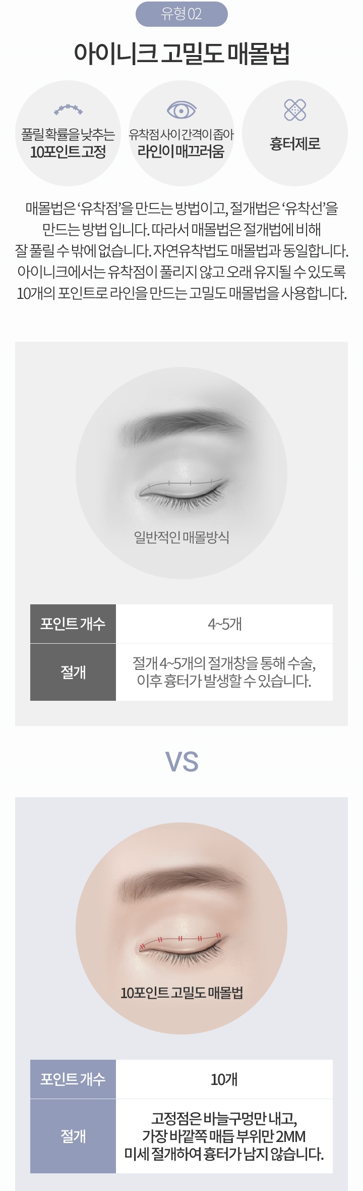 쌍꺼풀절개법전후 비교해보고 결정하세요! 관련 이미지 4