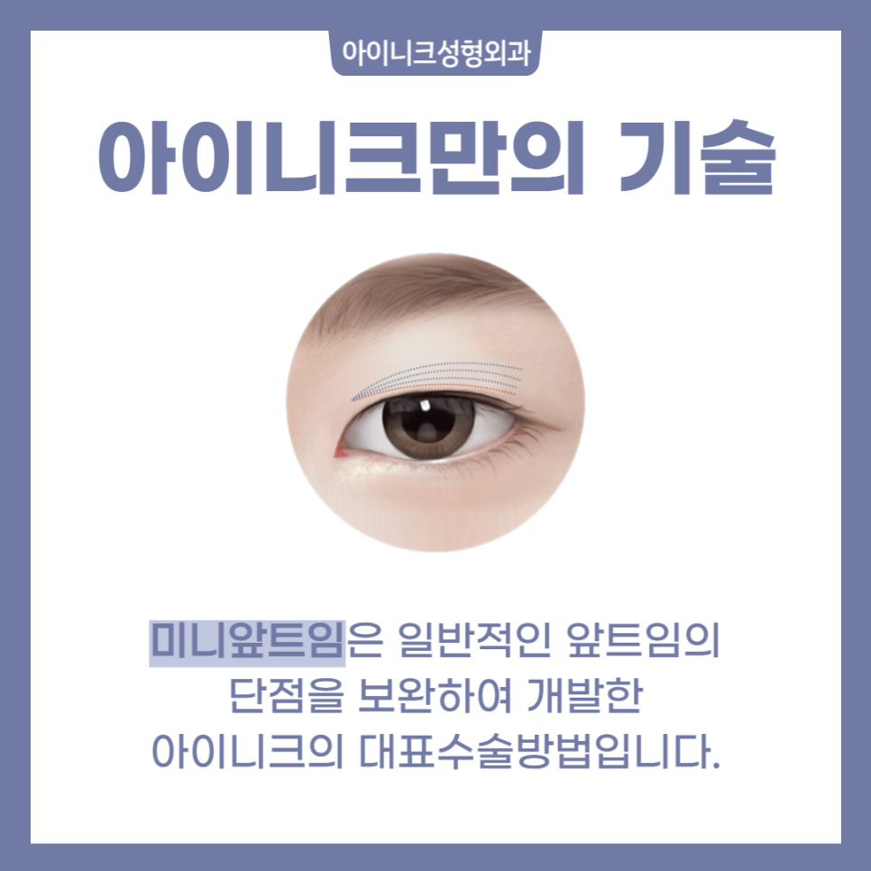 Full Eye Corners, Various Types! image 3