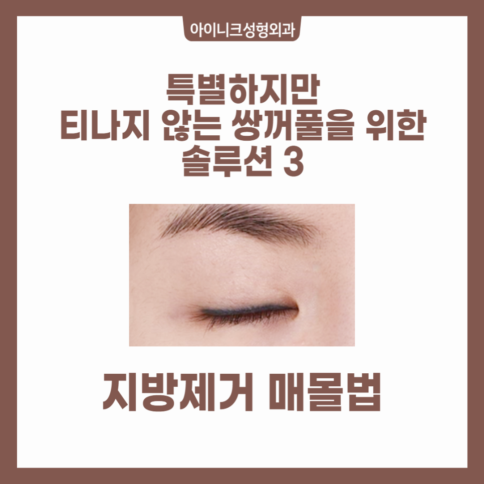 성형외과 발품 팔기? 강남쌍수병원 아이니크가 정답 관련 이미지 5