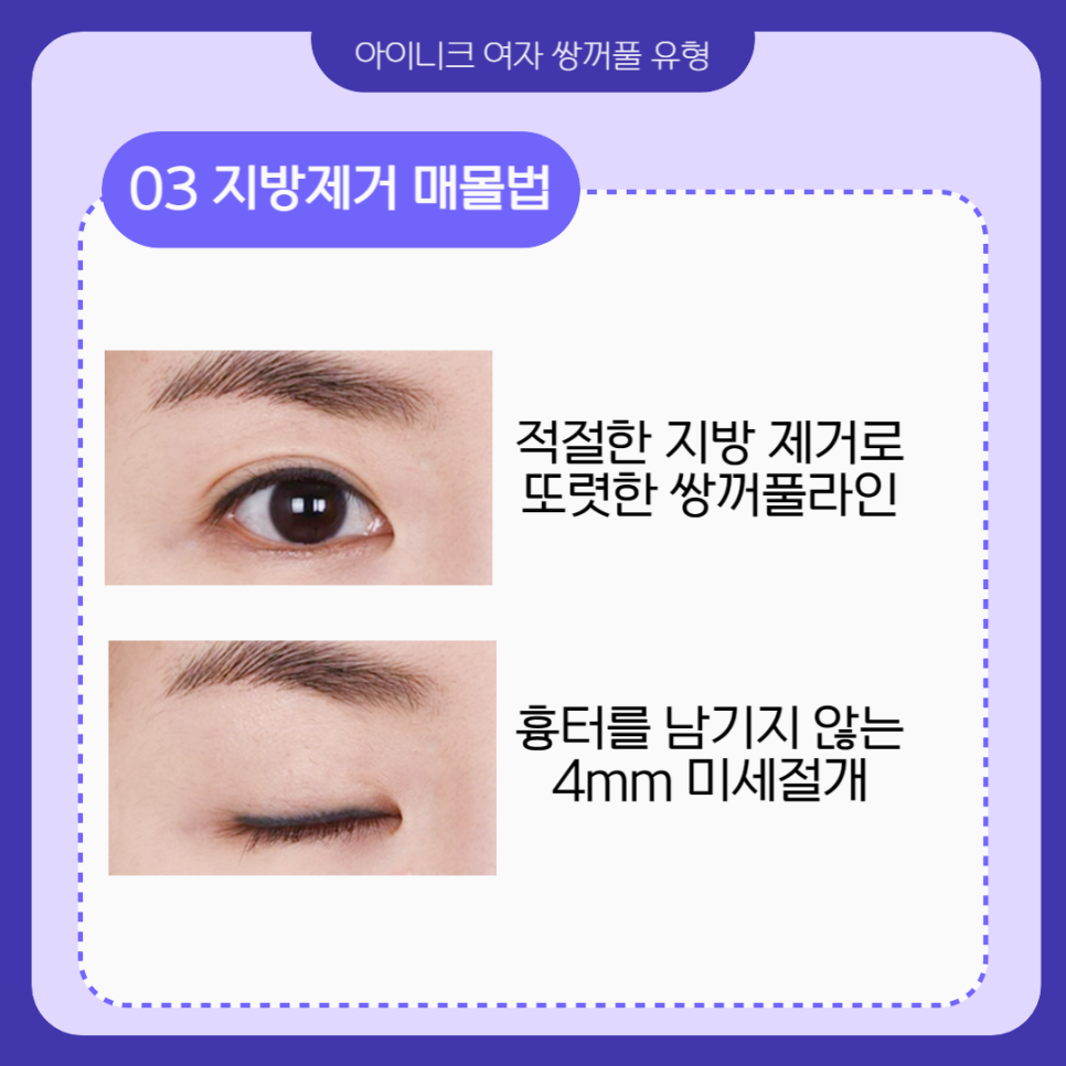 여자쌍꺼풀 나만의 디자인을 찾고있나요? 관련 이미지 4