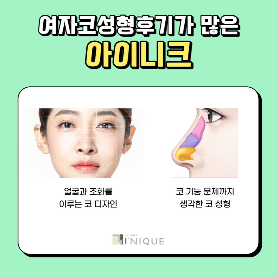 여자코성형후기가 증명하는 아이니크 관련 이미지 2