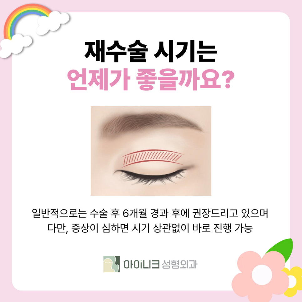 Revision Surgery for “Sausage Eyes”: How Should Thick Double-Eyelid Folds Be Corrected? image 6