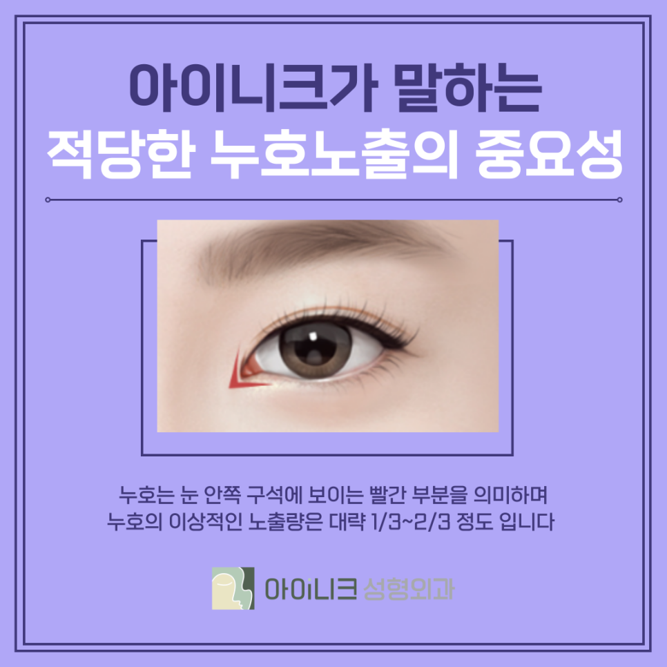압구정눈재수술잘하는곳 실패를 성공으로 바꾸기 관련 이미지 5
