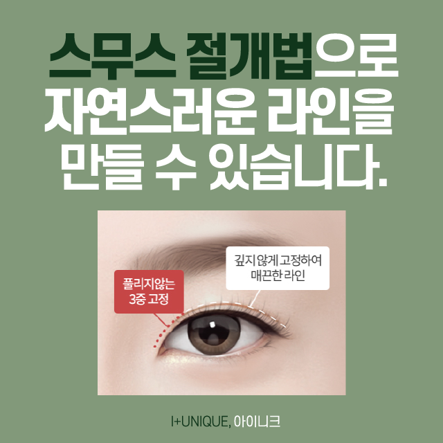 흑역사 없는 졸업사진 찍는 법? 아이니크의 눈쌍꺼풀수술! 관련 이미지 2
