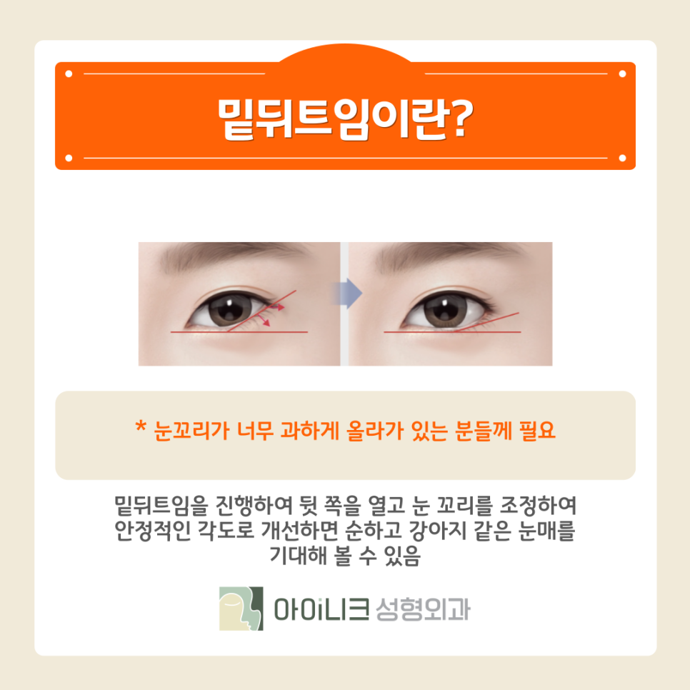 눈꼬리올리기 또렷하고 자연스러운 눈으로 관련 이미지 12
