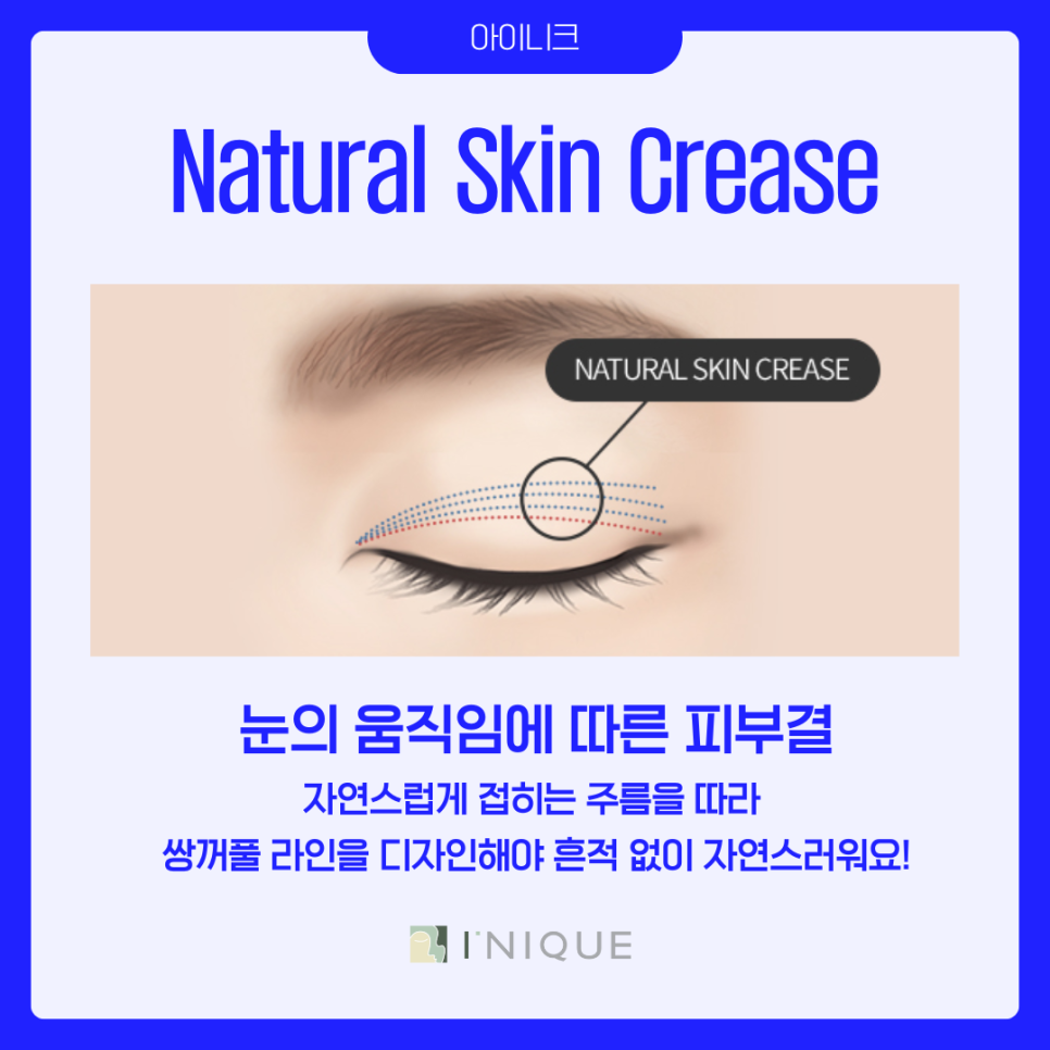 압구정 쌍수 라인 추천 어떻게? 관련 이미지 5