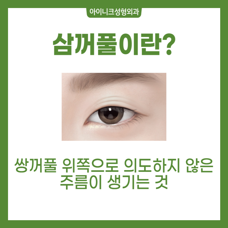 Double Eyelid Revision Surgery: You Need to Understand the Cause to Solve It! image 2
