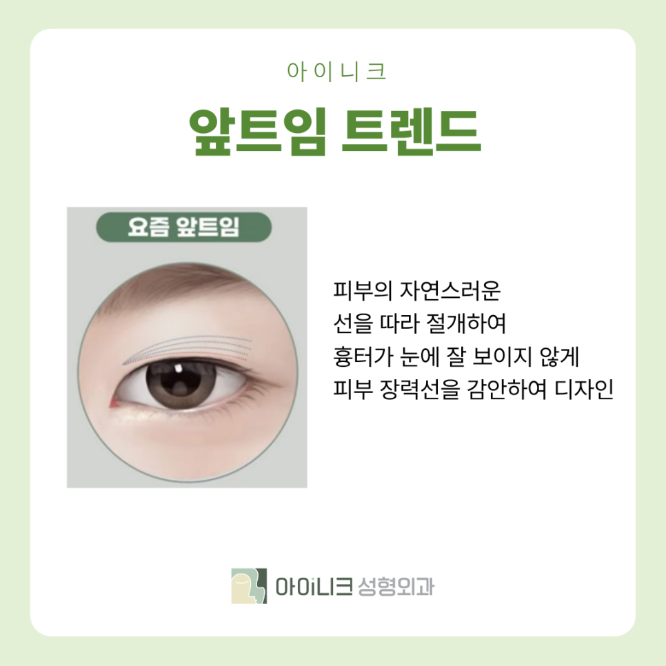 눈성형잘하는곳 2026 눈성형 트렌드는?? 관련 이미지 4