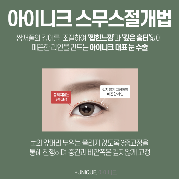 강남눈수술 유명한 병원을 찾고 있다면 아이니크성형외과가 답이다. 관련 이미지 3