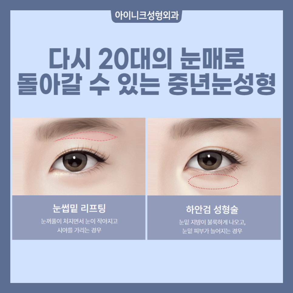 중년눈성형 고민이라면? 관련 이미지 2