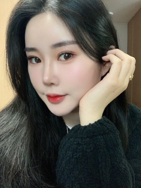 이마거상성형외과에서 노안 해결! 관련 이미지 1