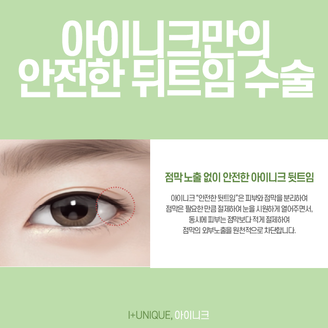 앞, 뒤트임재수술은 아이니크 성형외과에서! 관련 이미지 5