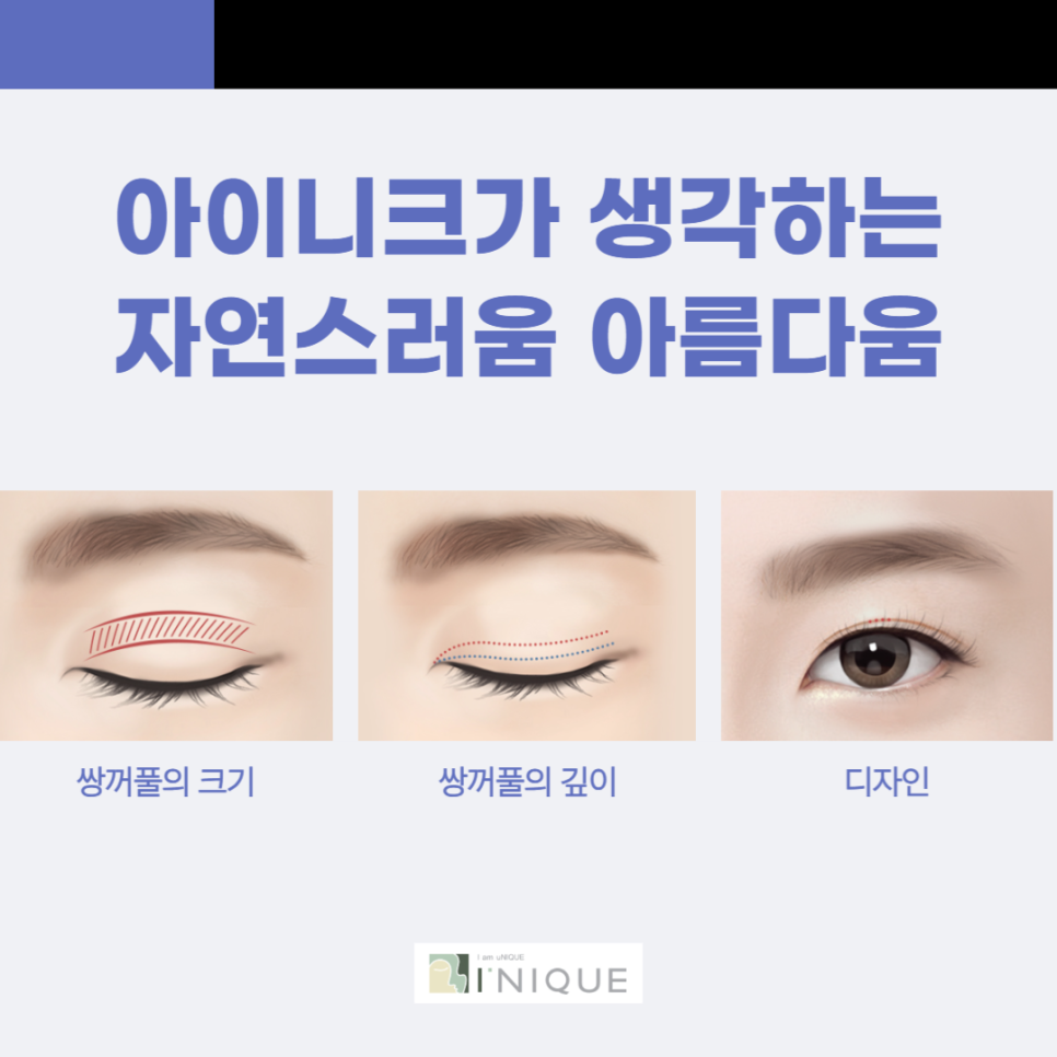 압구정 쌍수잘하는곳 아이니크 관련 이미지 3