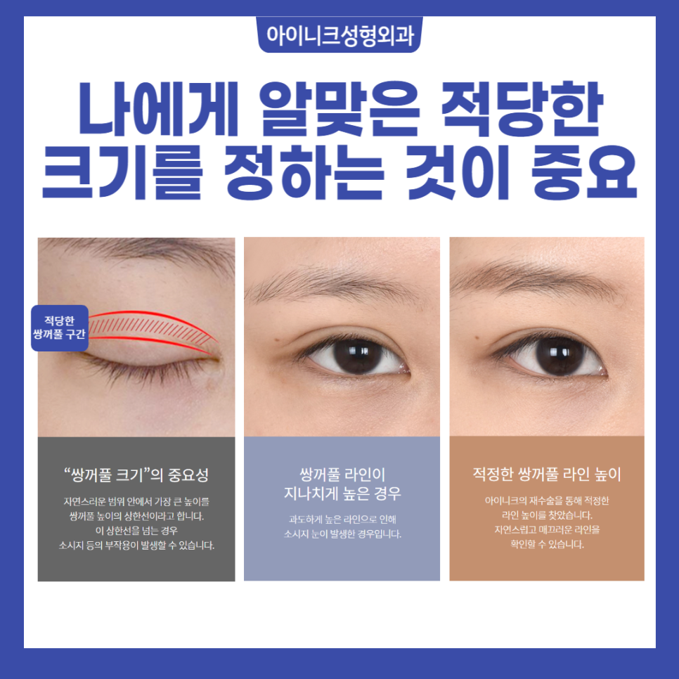 What Is More Important Than the Cost of Double Eyelid Surgery? image 4